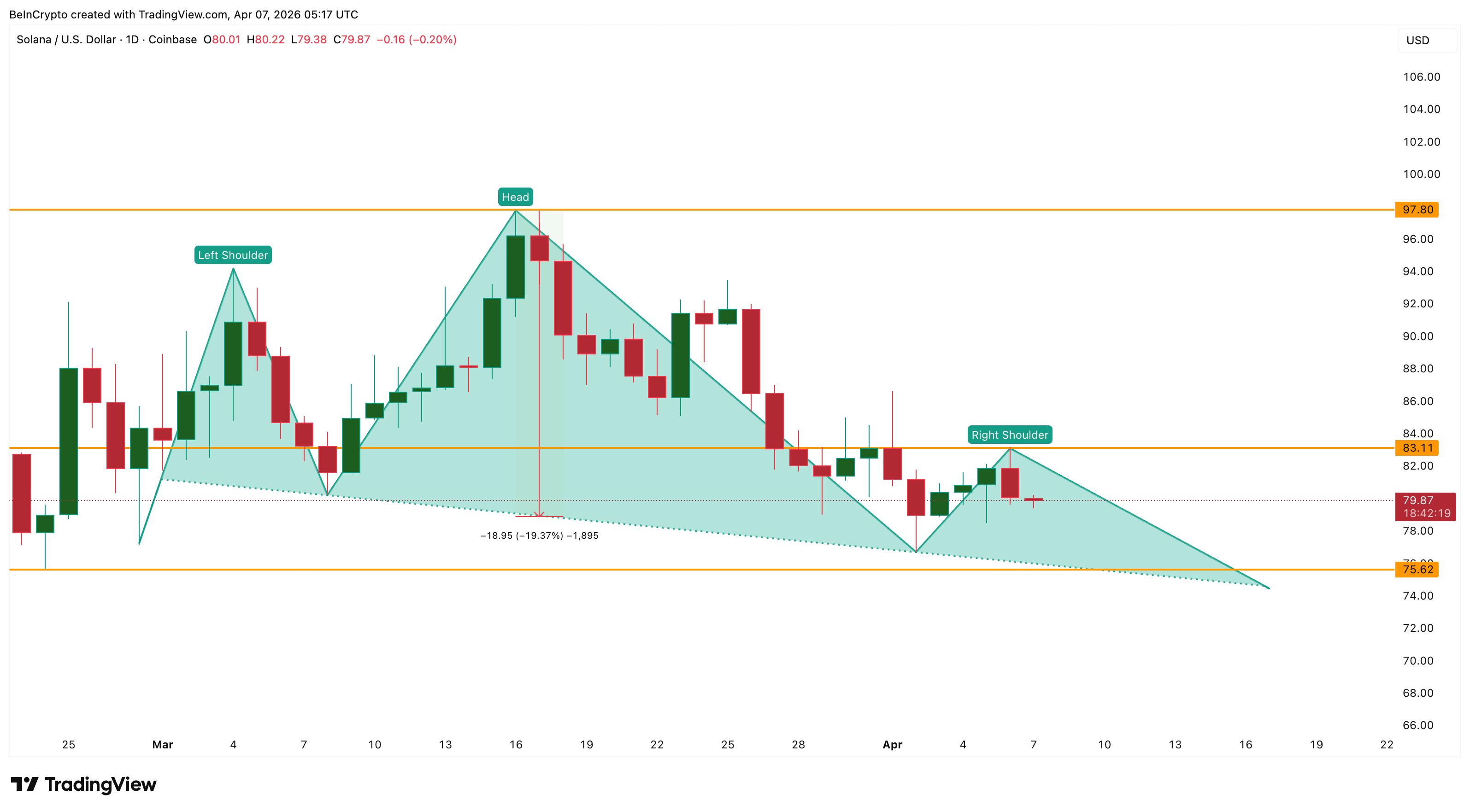 Mô hình Vai-Đầu-Vai