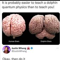 Brain