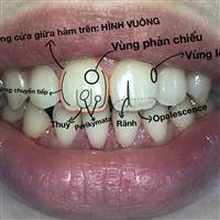 Mưu Cầu Hạnh Phúc